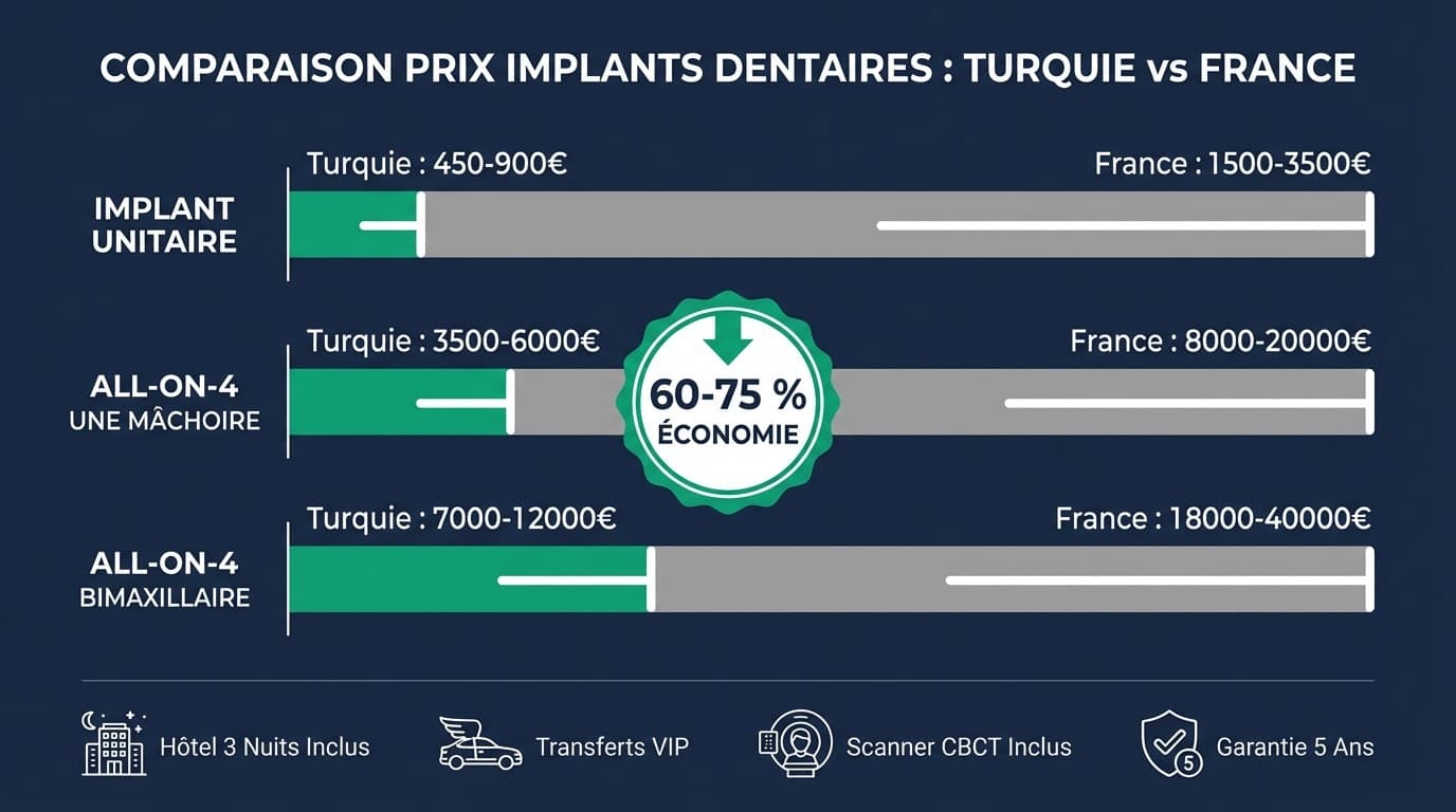 Infographie comparant les prix d'implants dentaires entre la Turquie et la France — implant unitaire, All-on-4, All-on-4 bimaxillaire avec économies de 60-75 %