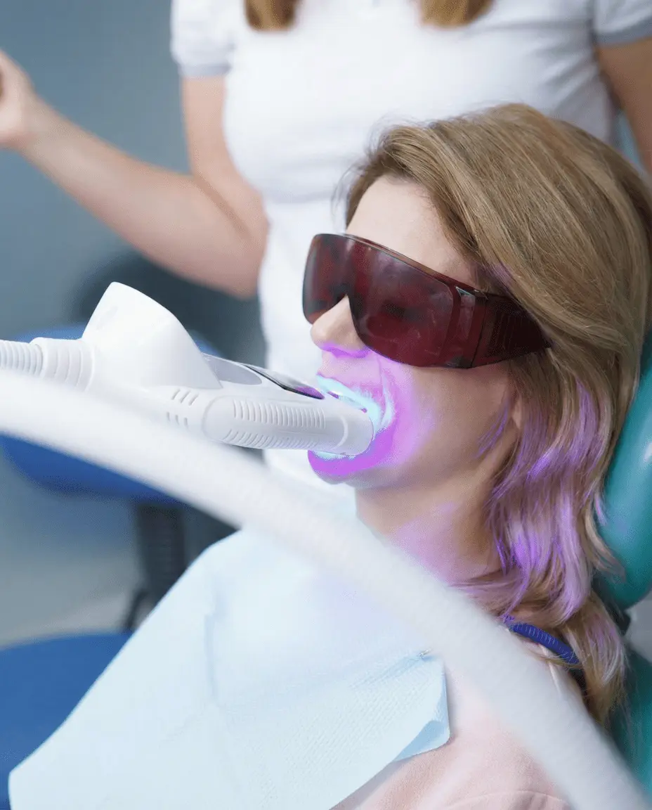 Blanchiment Laser