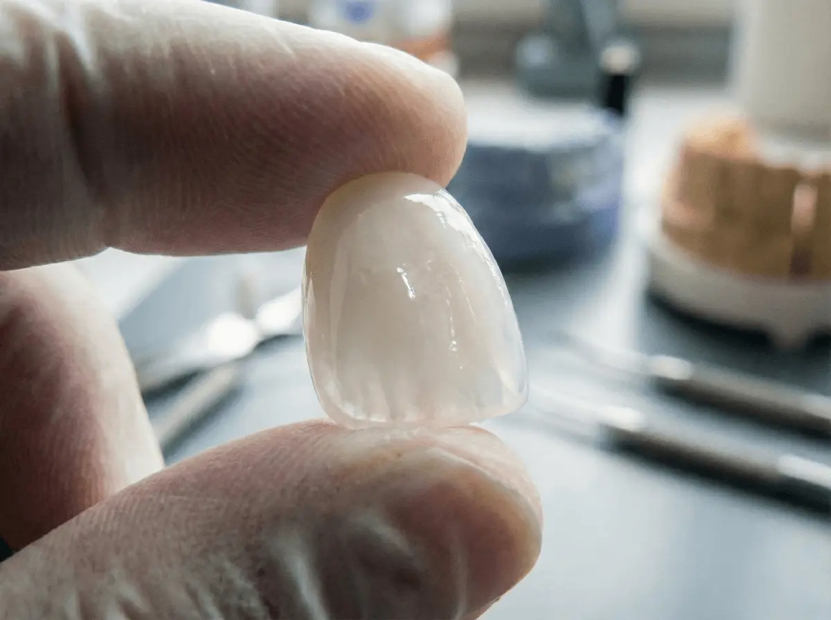 Facettes Emax & Zircone Renaissance Clinique