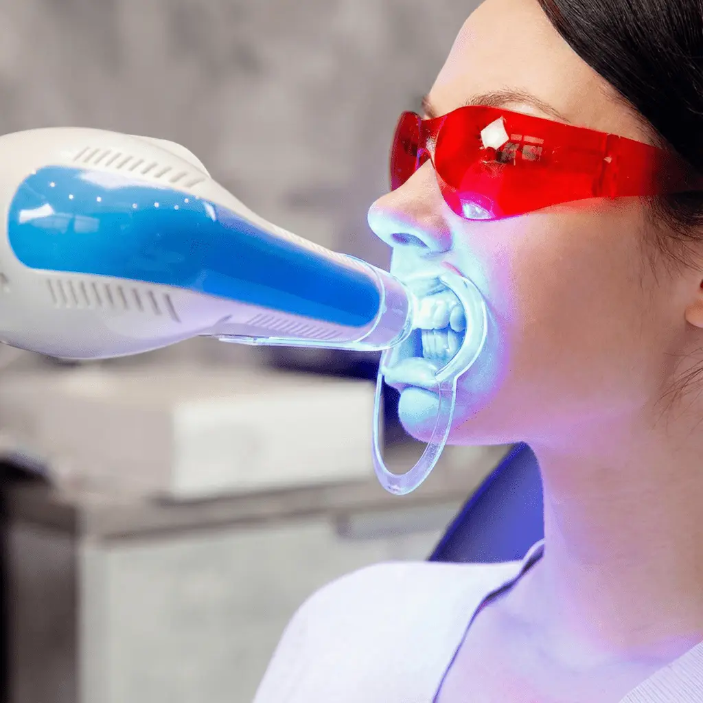 Blanchiment Laser