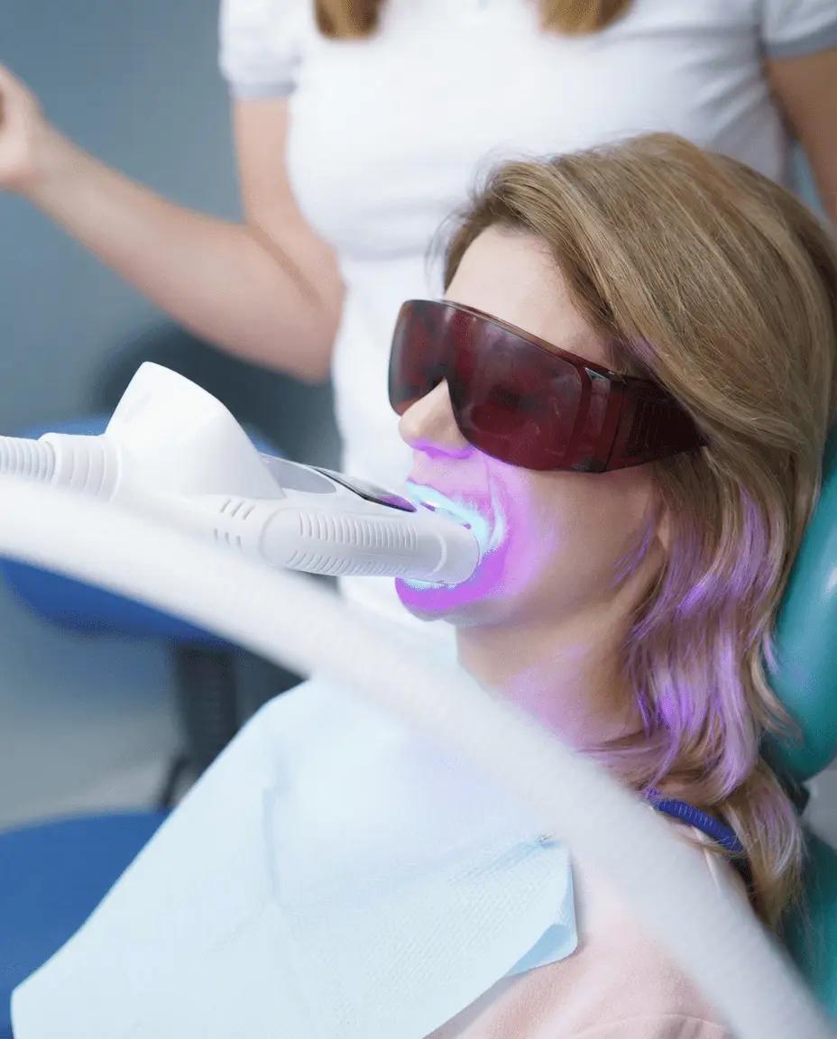 Blanchiment Laser