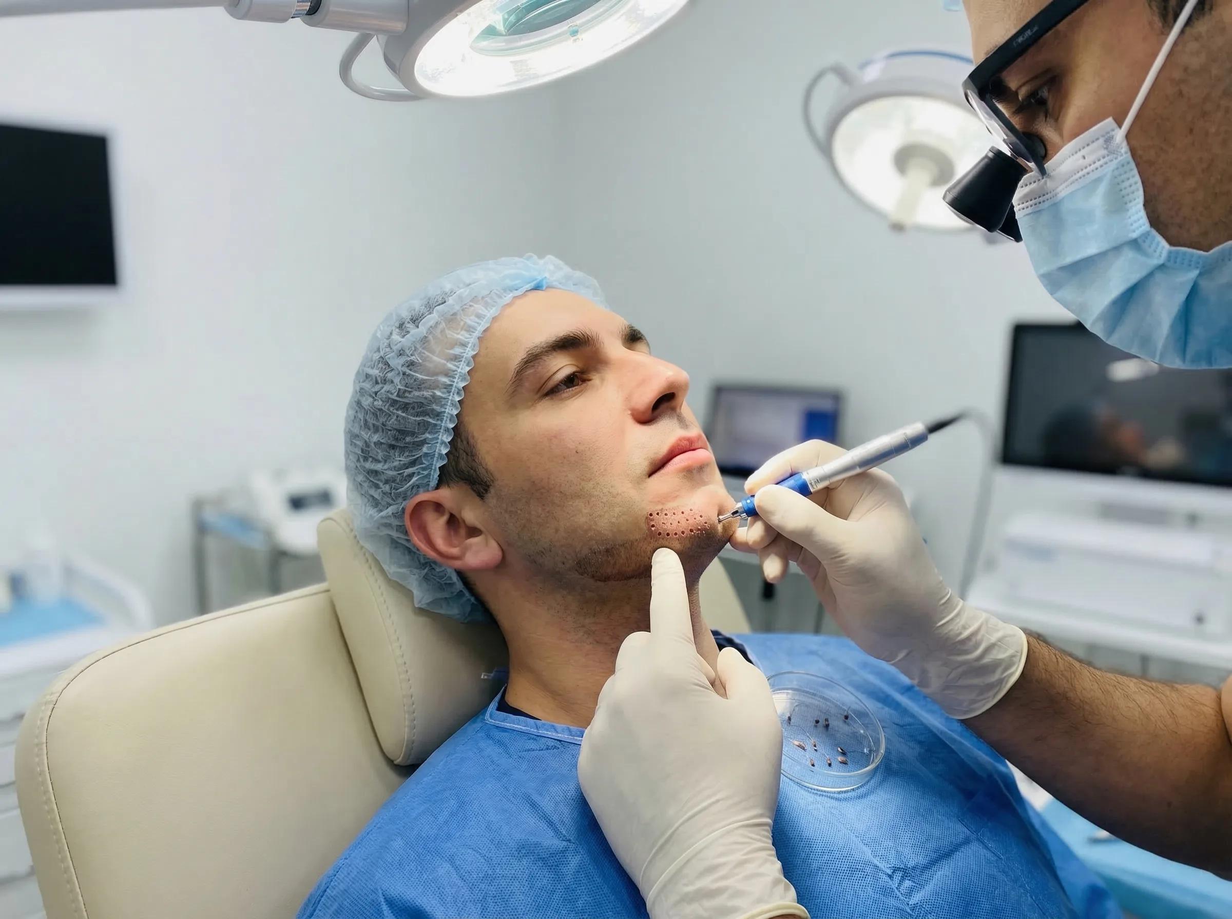 Greffe de Barbe Choi Pen — Alternative Permanente au Minoxidil | Renaissance Clinique Greffe de barbe Choi Pen : alternative permanente au Minoxidil — résultat avant et après montrant une barbe dense et naturelle sans effets secondaires