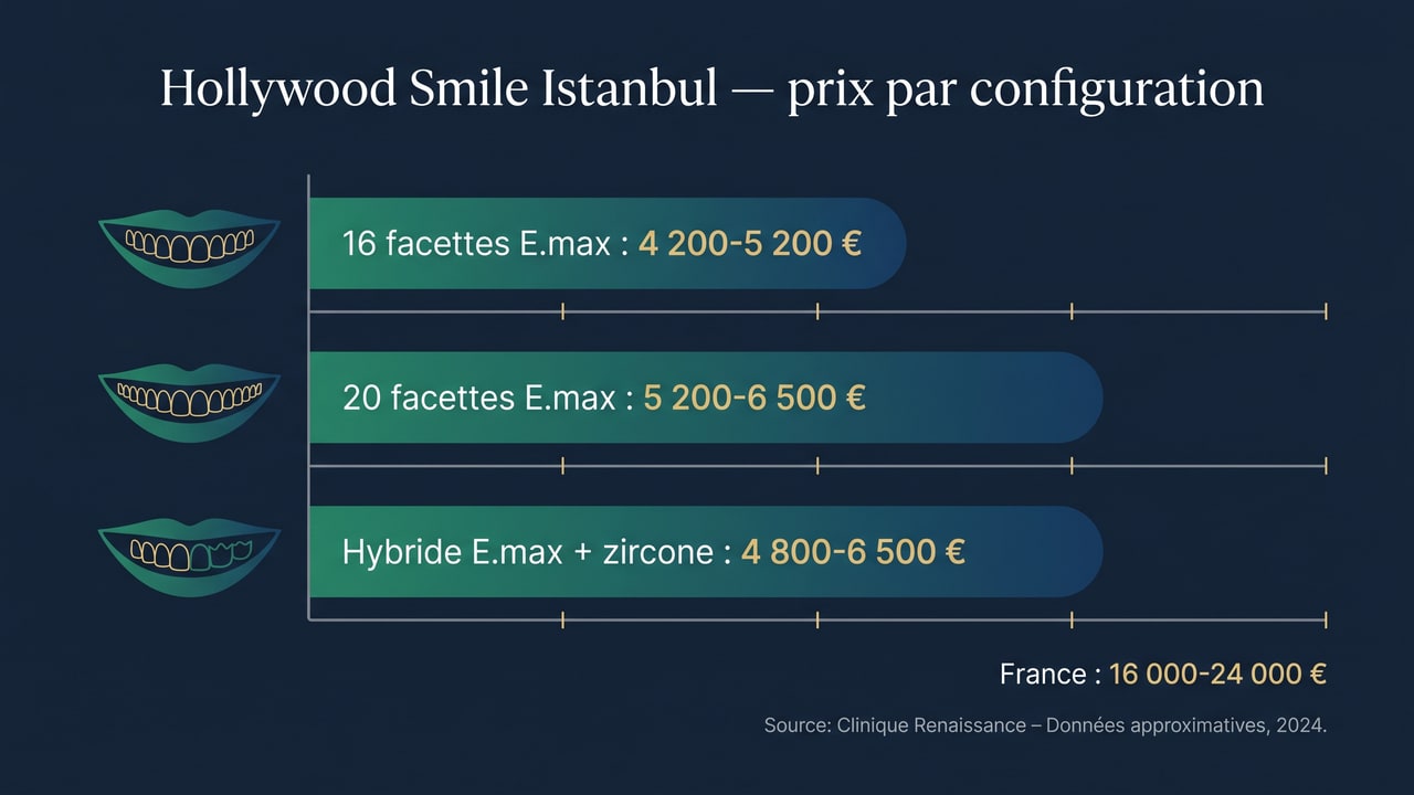 Prix du Hollywood Smile à Istanbul selon la configuration — 16 facettes, 20 facettes, approche hybride