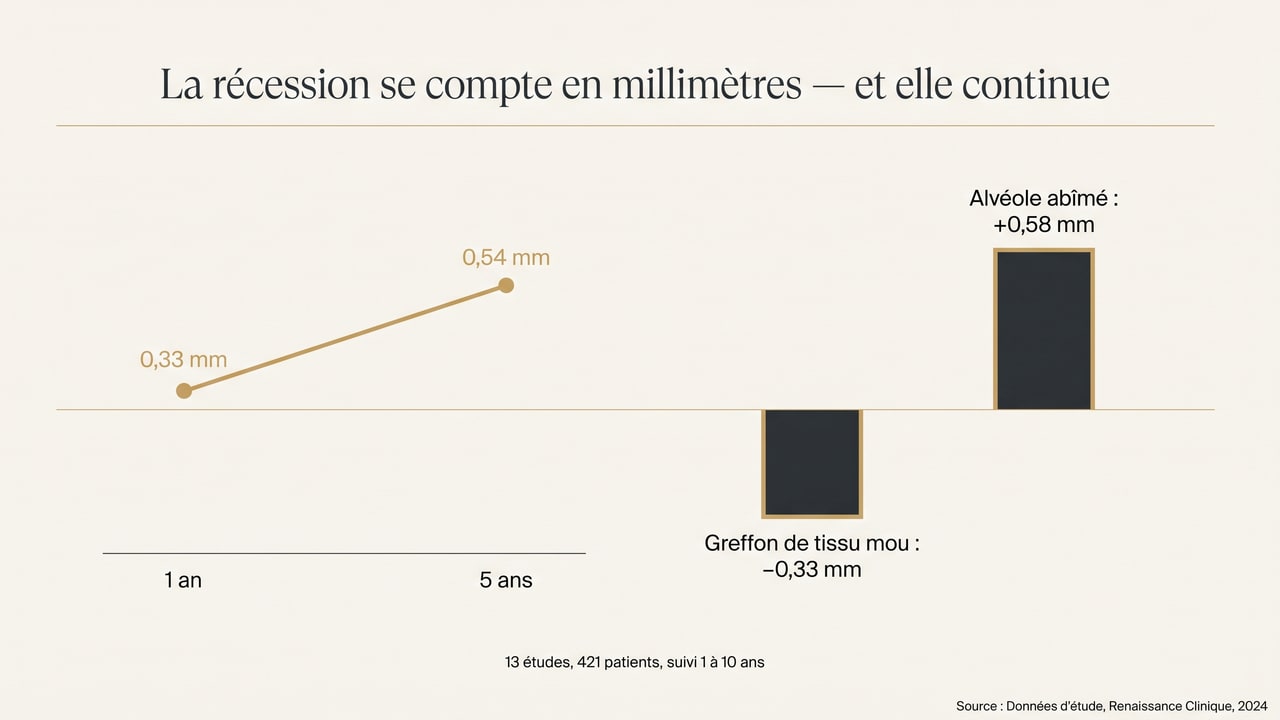 Graphique montrant la progression de la récession vestibulaire après implant immédiat et l'effet du greffon de tissu mou et d'un alvéole abîmé