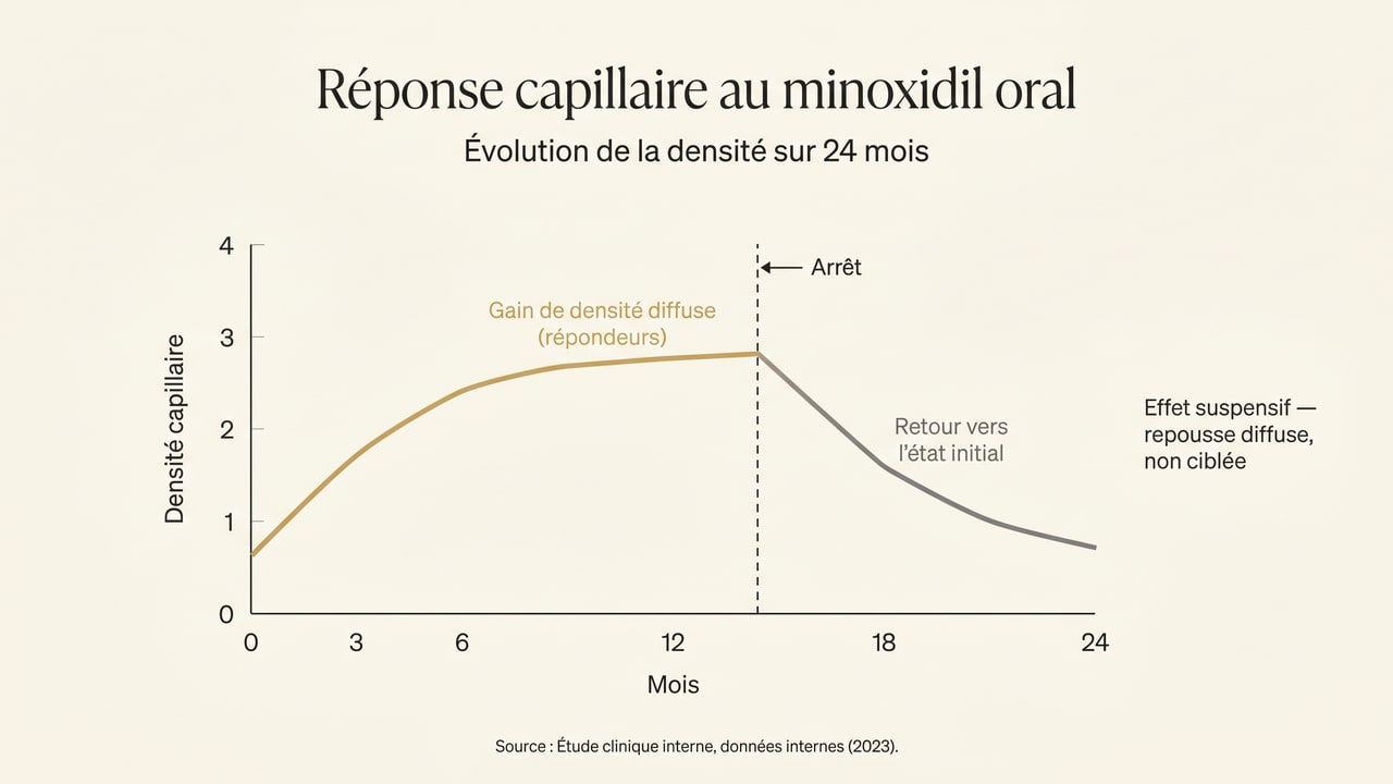 Courbe de la réponse capillaire au minoxidil oral : densification diffuse temporaire puis retour vers l'état initial après l'arrêt