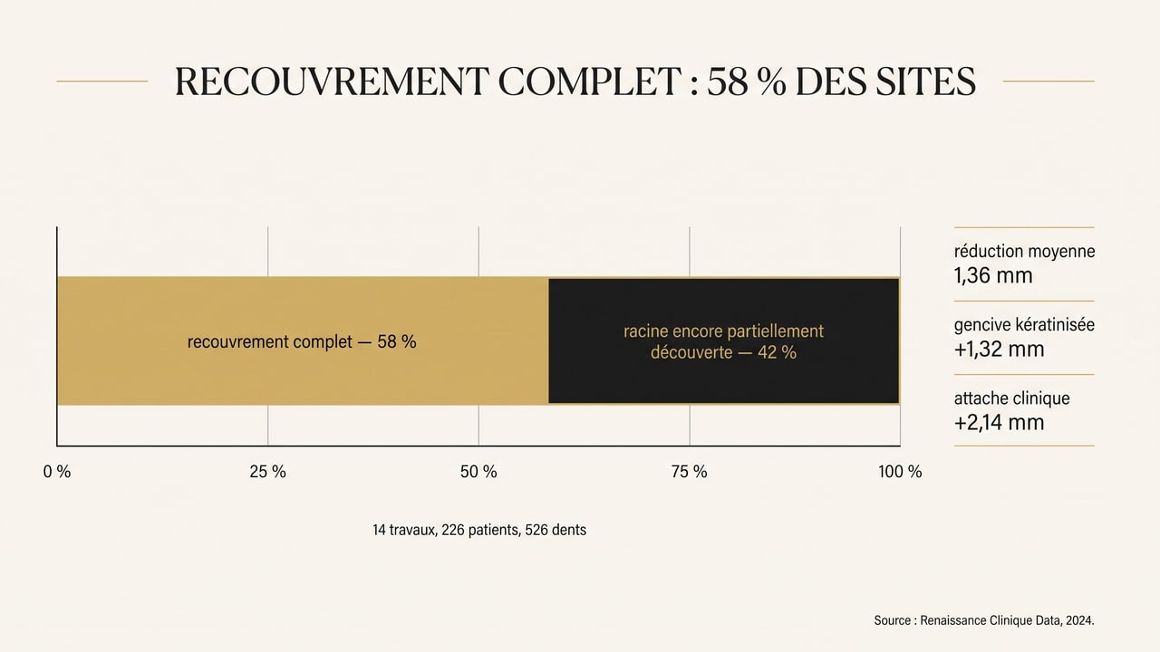 Graphique montrant que le recouvrement radiculaire complet est obtenu dans 58 % des sites traités
