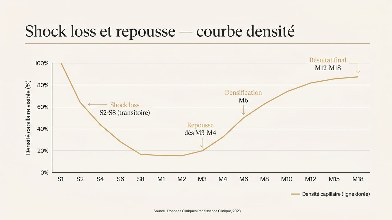 Courbe de densité capillaire après greffe : chute transitoire (shock loss) entre la 2e et la 8e semaine puis repousse progressive de M3 à M18