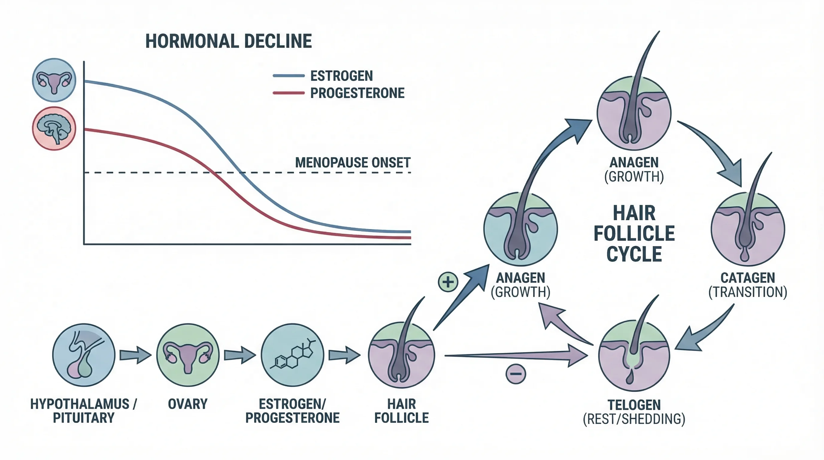 Schéma du mécanisme hormonal de la perte de cheveux féminine à 50 ans : baisse des œstrogènes, augmentation relative de la DHT, miniaturisation des follicules du vertex