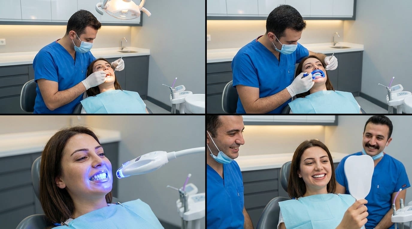 Déroulement du blanchiment dentaire étape par étape — Clinique Istanbul | Renaissance Clinique Étapes du blanchiment dentaire professionnel en clinique à Istanbul : examen, protection gingivale, activation LED et résultat final