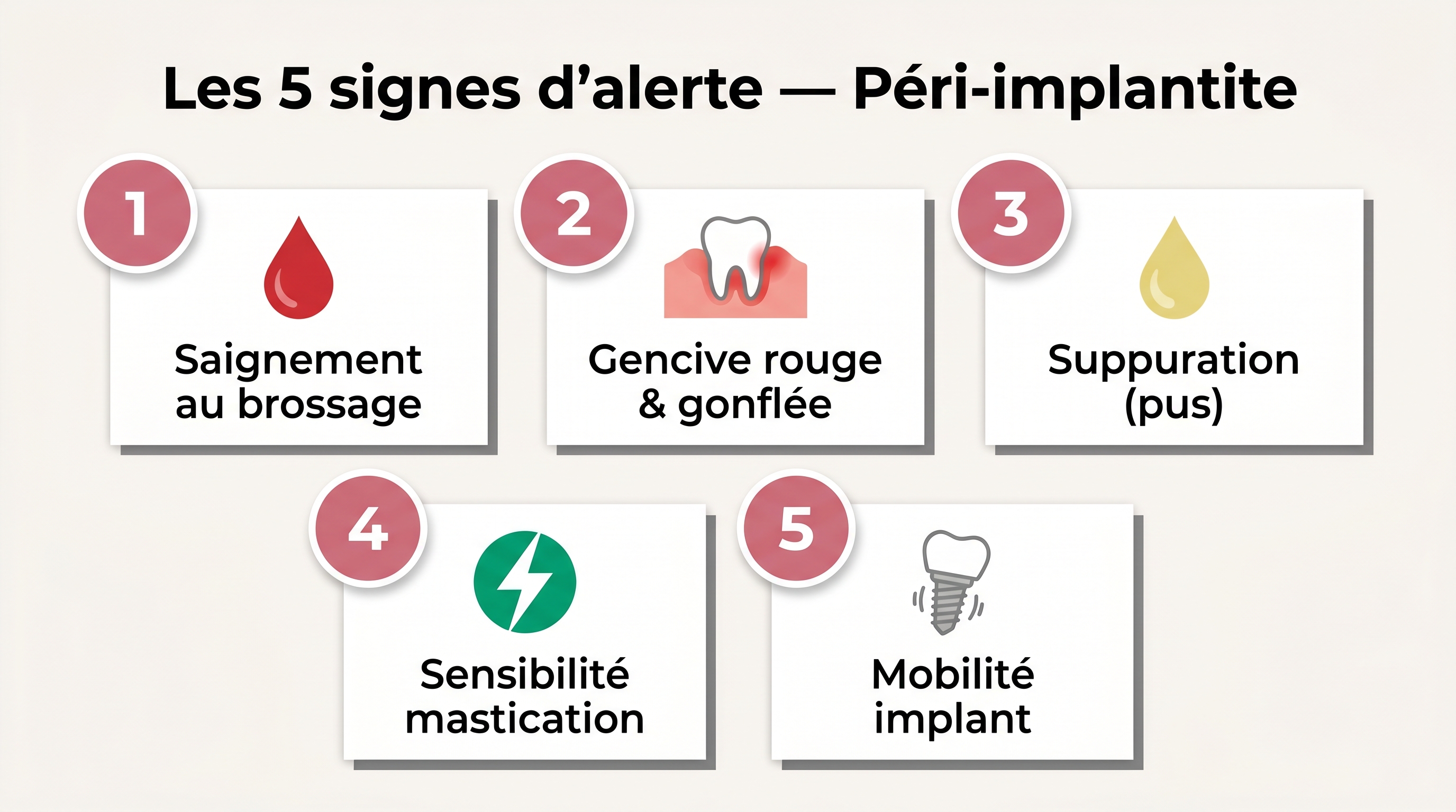 Infographie vue clinique en flat design présentant exactement 5 signes d'alerte de la péri-implantite numérotés de 1 à 5 en français : 1 Saignement au brossage icône goutte rouge, 2 Gencive rouge et gonflée icône inflammation, 3 Suppuration (pus) icône goutte jaune, 4 Sensibilité à la mastication icône éclair, 5 Mobilité de l'implant icône vis qui bouge — palette emerald/rose/gris, badges numériques circulaires, arrière-plan blanc cassé, toutes les étiquettes en français